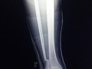 Foo Fighters cancelen Europese festivaltour