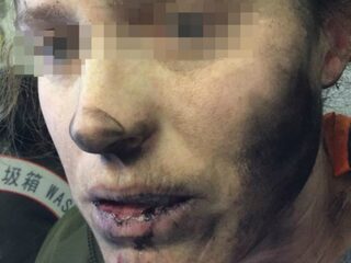 Koptelefoon ontploft in vliegtuig