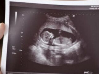 "Wees voorzichtig met de keuze voor een abortus te veroordelen"