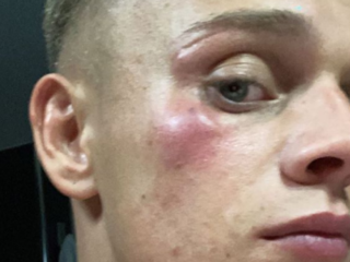 Dennis Schouten in elkaar geslagen om "maken van k***** video's"