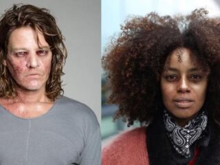 'Besmette' BN'ers vragen aandacht voor ebola met heftige foto's