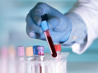 Nederlandse bloedbanken gaan onderzoek doen naar immuniteit coronavirus