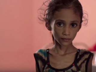 85.000 kinderen in Jemen gestorven aan hongersdood