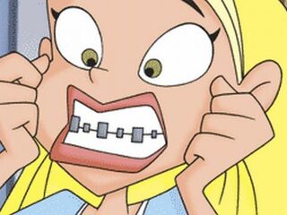 Deze 9 struggles herkent iedereen die een beugel had (of heeft)