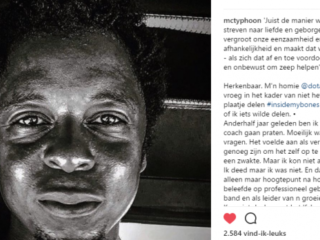 Instagrammers delen verhalen over eigen imperfecties #insidemybones