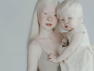 Deze twee zusjes met albinisme veroveren Instagram met hun prachtige foto's