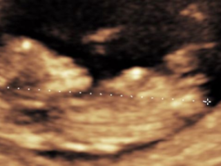 Murda wordt vader en deelt echo en hartslag van kindje