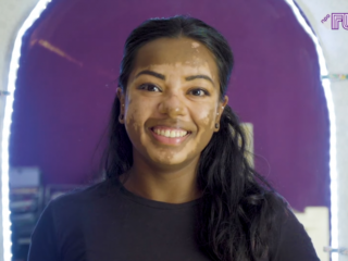 Sharista verbergt zichzelf en haar vlekken niet meer