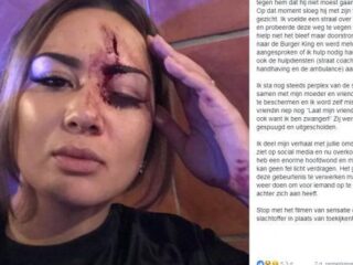 Vrouw toegetakeld terwijl ze jongen probeerde te beschermen