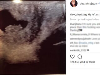 Vriendin van XXXTentacion is zwanger van zijn kind