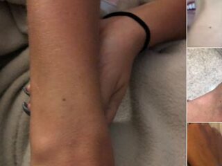 Vrouwen op Twitter worden gek: bijna iedereen heeft dezelfde moedervlek