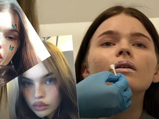 Filterverslaving: naar de cosmetische chirurg om op je favoriete filter te lijken