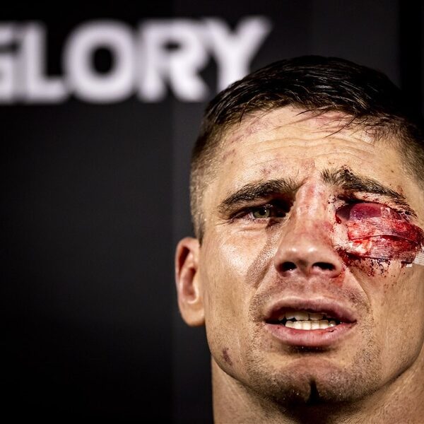 Rico Verhoeven wint tijdens bloederige wedstrijd van Jamal Ben Saddik