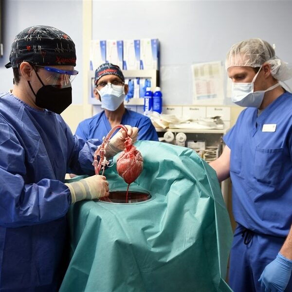 Man die als eerste mens ooit genetisch aangepast varkenshart kreeg overleden