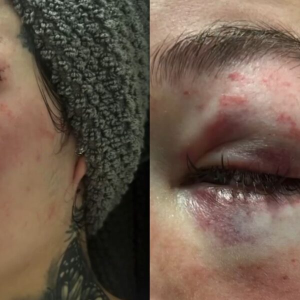 Bhad Bhabie deelt beelden van mishandelingen: "Deze man wil mijn baby afpakken"