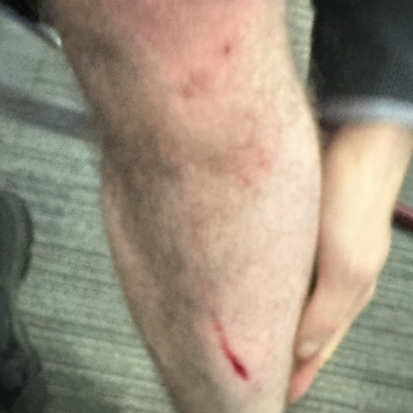 Blinde BBC-verslaggever overmeestert iPhone-dief