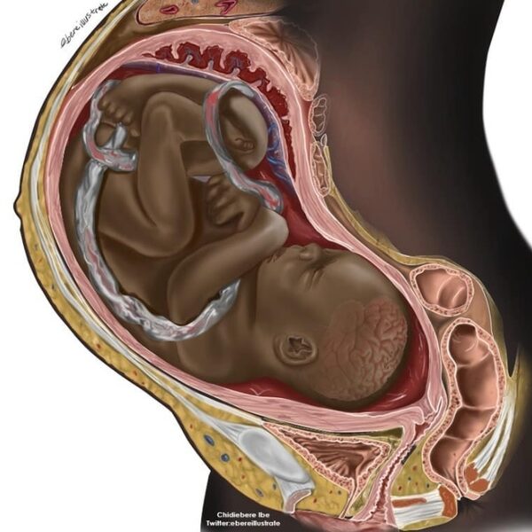 Illustraties van student die zwarte foetus tekende worden gepubliceerd in boek