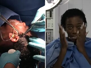 TikTokker na een maand verlost van lijmspray in haar