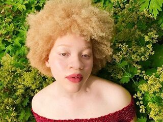 Fareda (18) werd gepest vanwege haar albinisme en wil nu inspiratiebron zijn als model