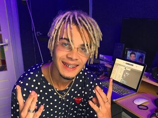 Oliver (21): "Fans van m'n muziek dm'en me: 'Hey jij hebt m'n beugel geplaatst'"