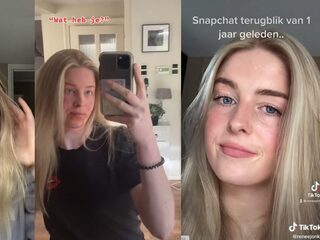 Renée (18) heeft extreem eczeem: "Het liefst blijf ik binnen"