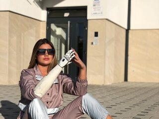 Ena (24) verloor haar hand maar blijft positief: 'Door te huilen groeit mijn hand niet terug'