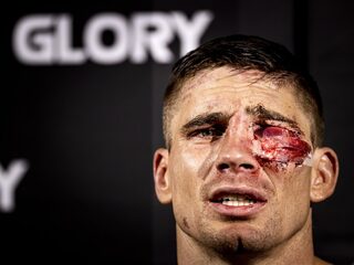 Rico Verhoeven wint tijdens bloederige wedstrijd van Jamal Ben Saddik