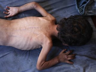 Vreselijke beelden van graatmagere Palestijnse peuter met vuilniszak als luier gaan viraal