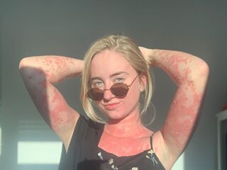 Debby (22): "Leven met psoriasis is heftig, maar ik heb het leren omarmen"