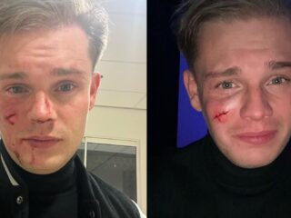 Roddeljournalist Dennis Schouten in zijn gezicht gestoken tijdens uitgaan