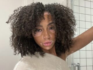 Mo-Yccia (20) heeft vitiligo en werd gescout als model: "Gaf me zelfvertrouwen"