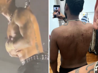 Miguel deelt bloedig resultaat nadat hij zich liet ophangen