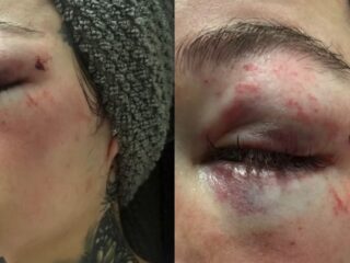 Bhad Bhabie deelt beelden van mishandelingen: "Deze man wil mijn baby afpakken"