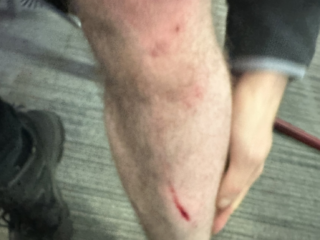 Blinde BBC-verslaggever overmeestert iPhone-dief