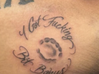 UFC-vechter wordt tijdens gevecht gebeten door tegenstander: laat gebitsafdruk tatoeëren