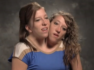 Helft van wereldberoemde Siamese tweeling (34) trouwt met oorlogsveteraan