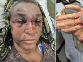 Boze reacties na mishandeling bejaarde Turks-Nederlandse vrouw: "Wereld is naar de klote"