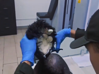 Colombiaanse man probeert 10.000 euro aan cocaïne onder zijn haar te smokkelen