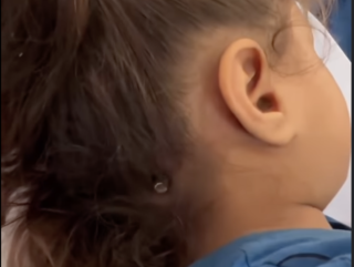 Vijfjarig Palestijns meisje in Gaza overleeft kogel in hoofd: "Kinderen zijn doelwit"