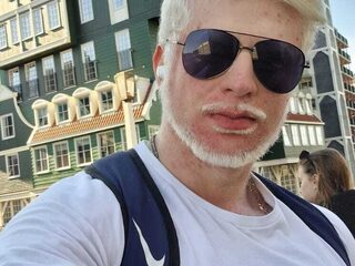 Zabih heeft albinisme en wordt vaak aangestaard: "Als je vragen hebt, stel ze gewoon"