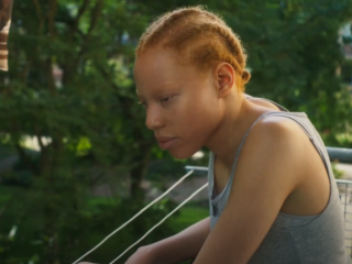 Latifa (21) speelt meisje met albinisme in film 'White Berry': "Ik hoop anderen te inspireren"