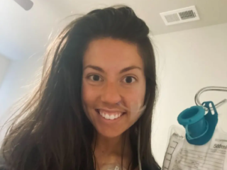 Vrouw (20) bekent 39.000 dollar gestolen te hebben als 'neppe kankerpatiënt'