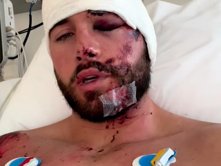 Donny Roelvink deelt emotionele video na heftig ongeluk: "Ik ben blij dat ik er nog ben"