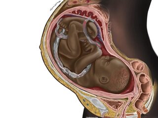Medisch student vertegenwoordigt mensen van kleur met medische illustraties