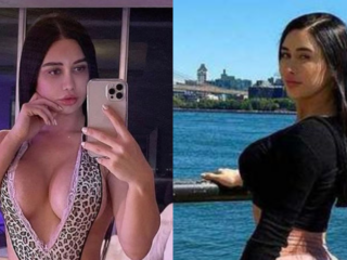 'Mexicaans topmodel overleden na mislukte biloperatie'