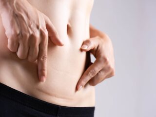 Eindelijk officiële benaming voor klachten na een keizersnede