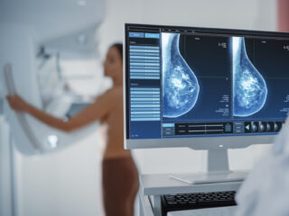 Cybercriminelen publiceren naaktfoto's borstkankerpatienten om ziekenhuis af te persen