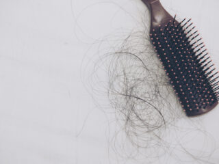 Medina (27) heeft haarziekte alopecia: "Ik belandde in een depressie"