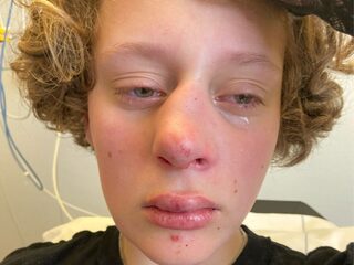 14-jarig Frédérique overladen met steun na zware mishandeling