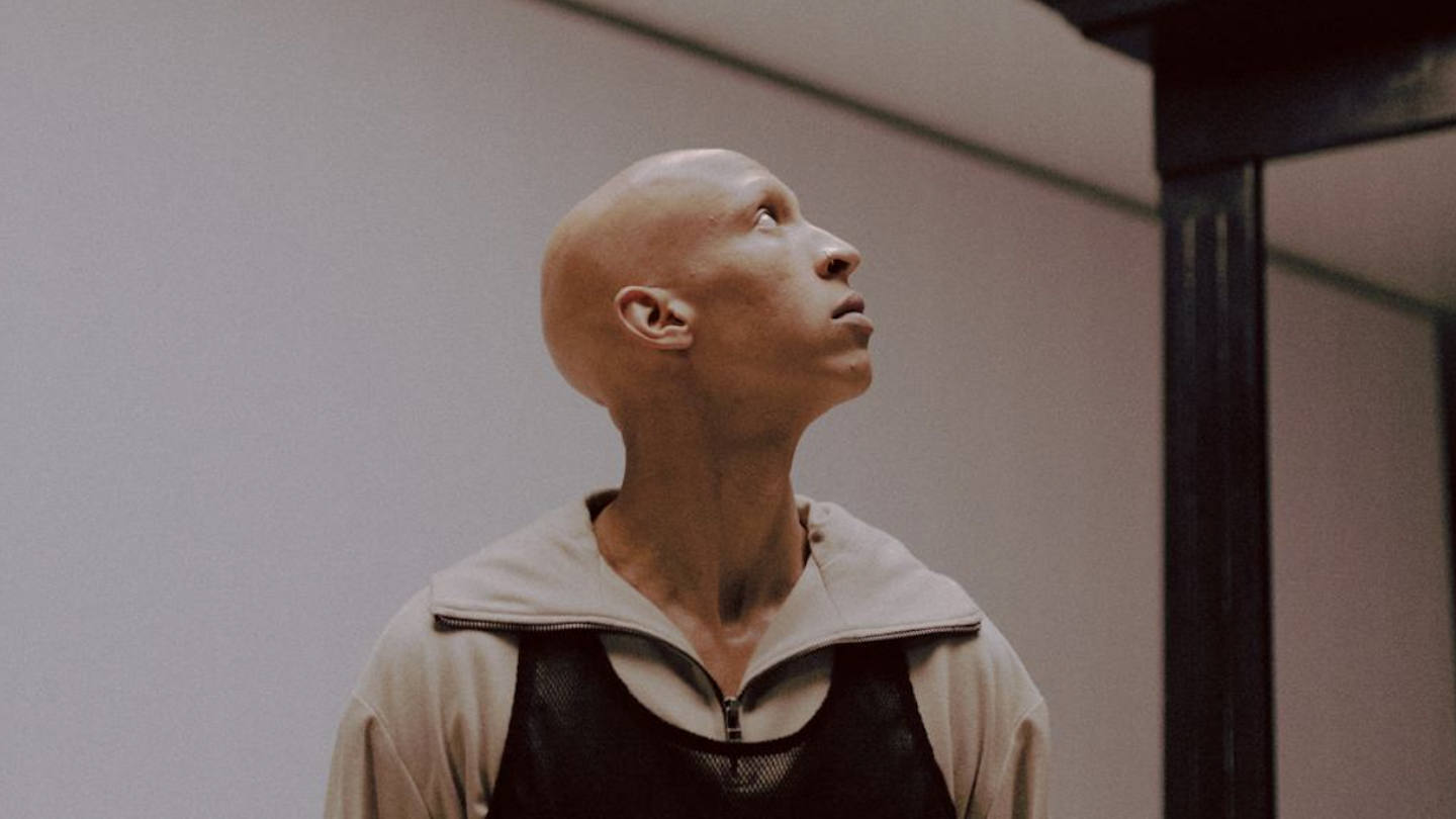Reilly leerde zijn alopecia omarmen en wordt er nu om gevierd: “Ik dacht dat ik raar was in hun ogen”